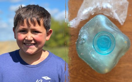 Dangerous TikTok trend leaves boy badly burned as doctors issue warning