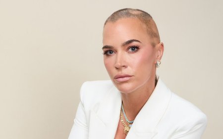 Teddi Mellencamp reflects one year after doctors found ‘plum-sized’ brain tumors, went to ER for 'migraines'