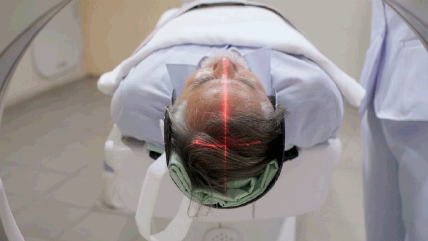 Hidden brain condition may quadruple dementia risk in older adults, study suggests