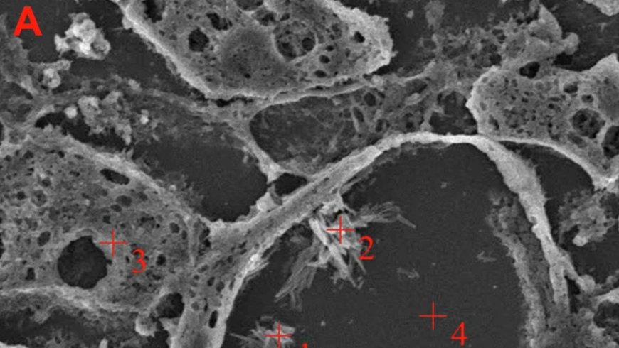 Plastic fragments found embedded in human brains… and there are quite a few: scientists discover levels 30 times higher than those found in the liver