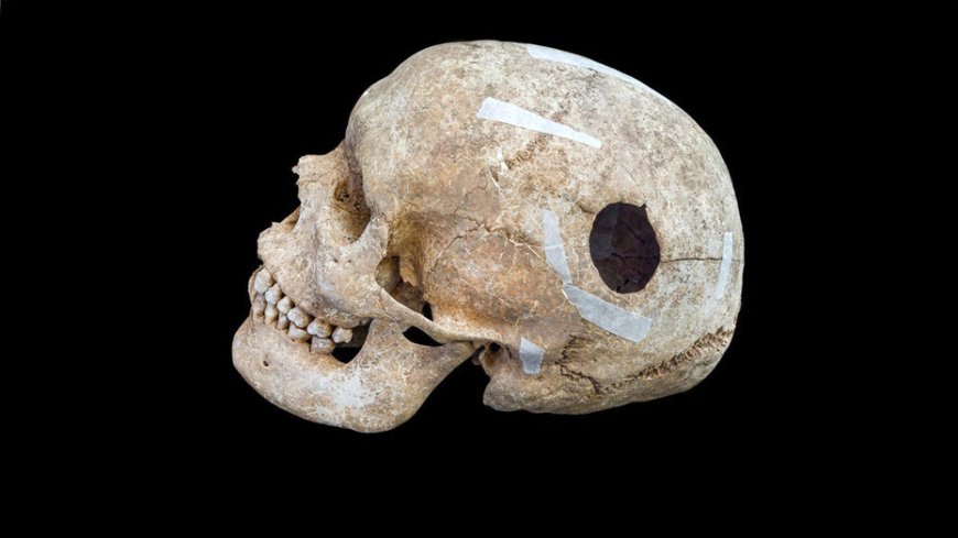 Archaeologists uncover evidence of early brain surgery on 9th-century man