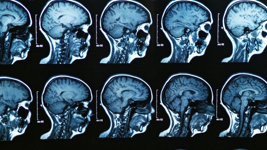 Your brain is not fully grown at 18 — scientists now say it keeps changing much longer