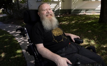 What It’s Like to Have a Brain Implant for 5 Years