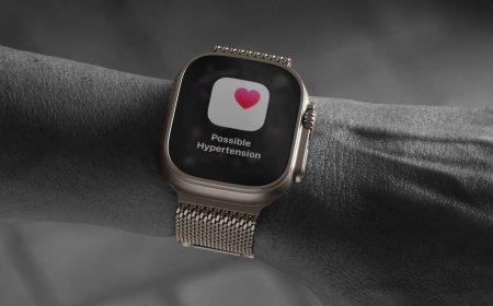 6 cheap accessories to make your Apple Watch more useful