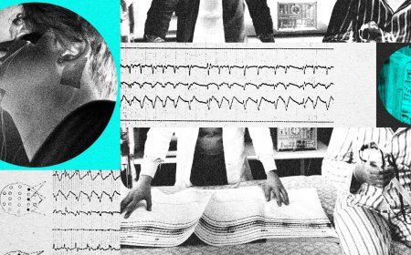 Technology Is Reshaping Sleep Apnea Treatment