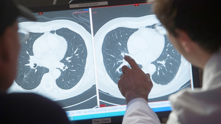 A cure for cancer would deliver $185T economic windfall, report says