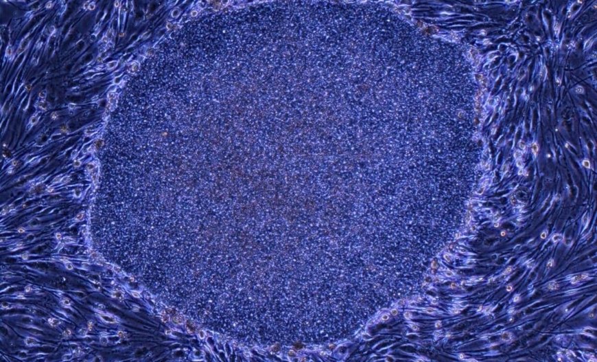 Japan Approves the World’s First Treatments Made With Reprogrammed Human Cells