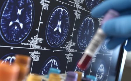 Bigger than balloons: Helium shortage hitting vital industries, Kansas geologist says