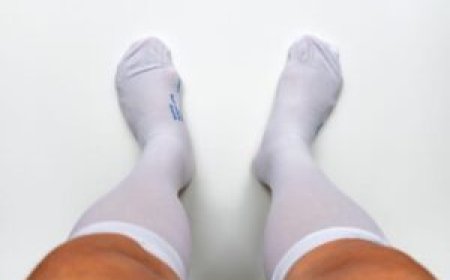 7 Hidden Blood Clot Symptoms That Send Thousands to the ER Every Year