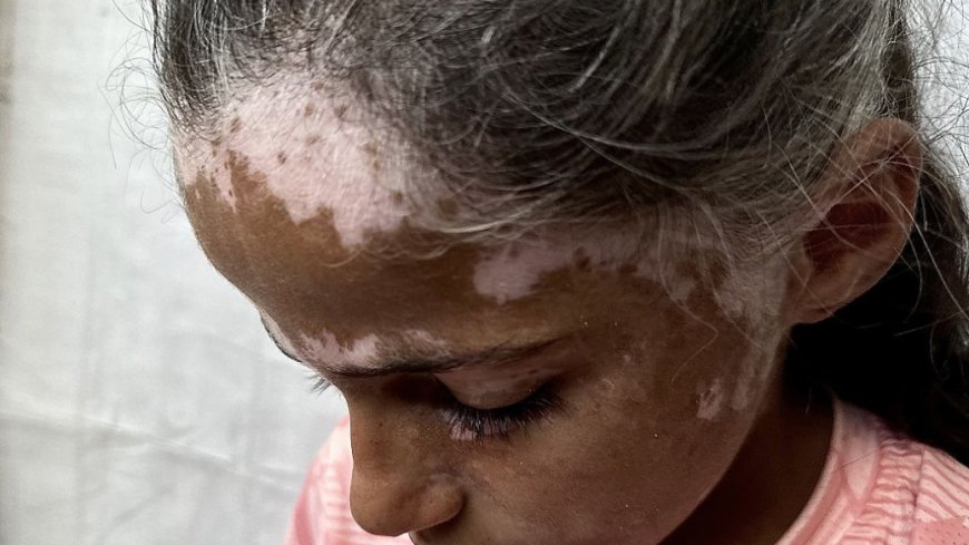 Amid Gaza’s rubble, families are trying to protect their children from suicide