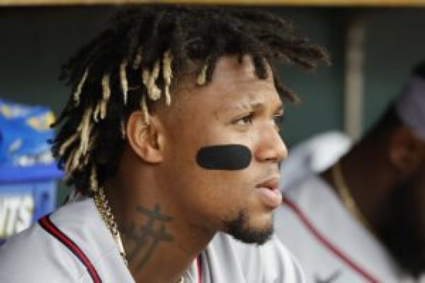 Braves’ Ronald Acuna Jr. (hand) day-to-day after HBP