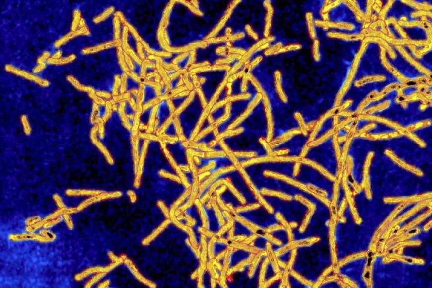 Legionnaires’ bacteria found in New York museum cooling systems: report