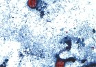 Cyclospora outbreak tied to lettuce now linked to 15 states: reports