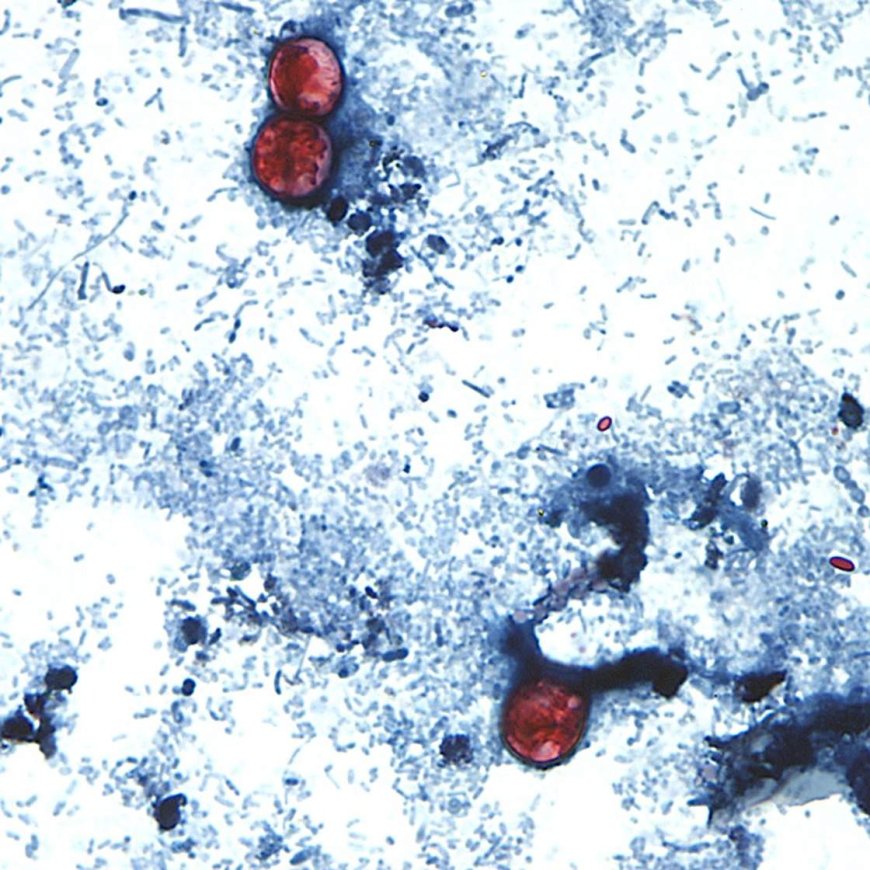 Cyclospora outbreak tied to lettuce now linked to 15 states: reports