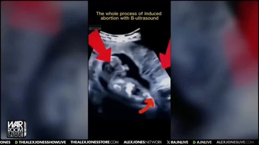 VIEWER DISCRETION ADVISED: Baby Fights And Scrambles For It’s Life Trying To Evade Metal Tools During Abortion In Ultrasound Video