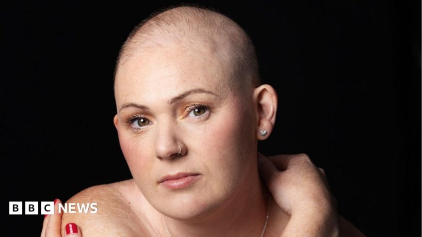 Chemo hair loss doesn't define me - it's a symbol that I'm strong