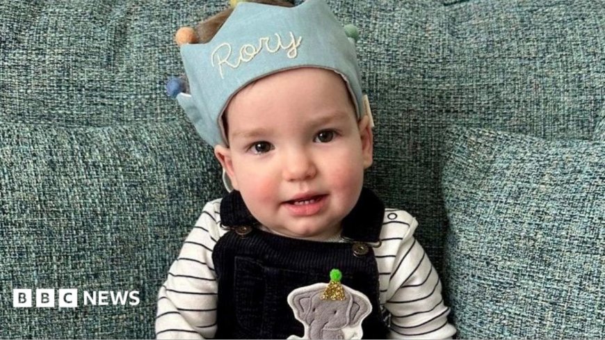 World-first surgery for baby's rare skull condition