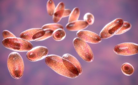 Suspected plague death in Russia prompts State Department monitoring