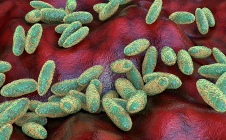 US 'closely monitoring' after Russian lab worker 'dies of suspected plague'