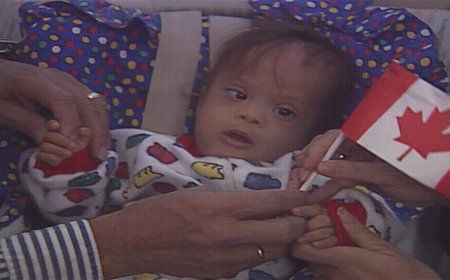 Baby Jose returns to Alberta nearly 30 years after life-saving surgery