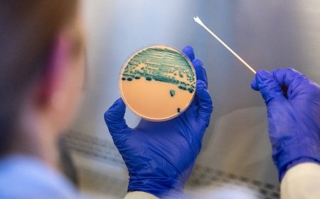 Stomach-turning sexually transmitted infection is on the rise — and standard medicines are failing